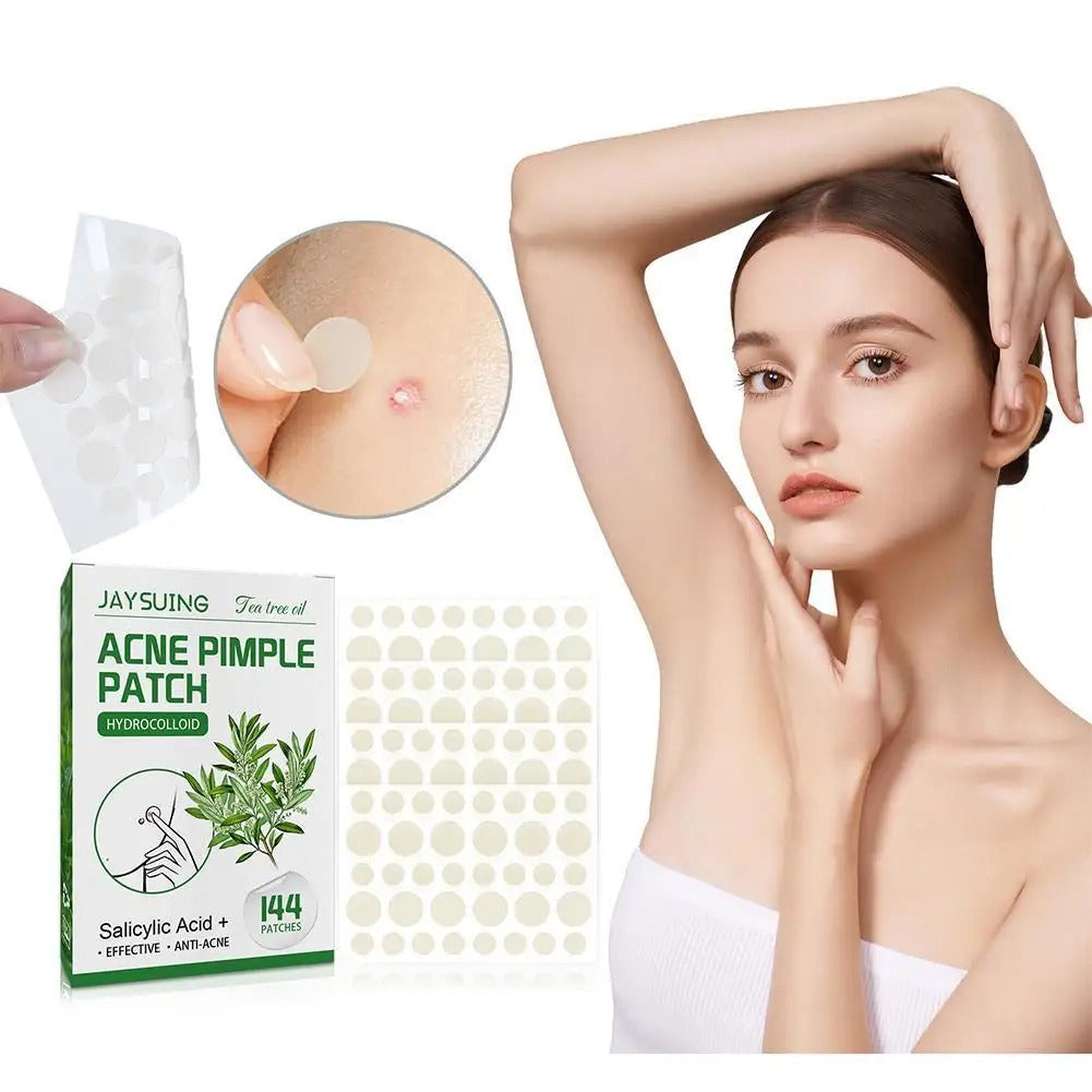 Woman applying an acne pimple patch infused with tea tree oil and salicylic acid.