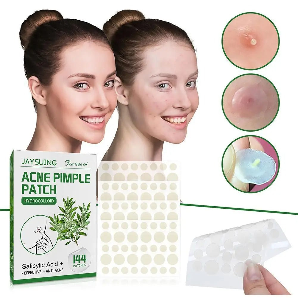 Acne patches helping heal blemishes and improve skin texture.