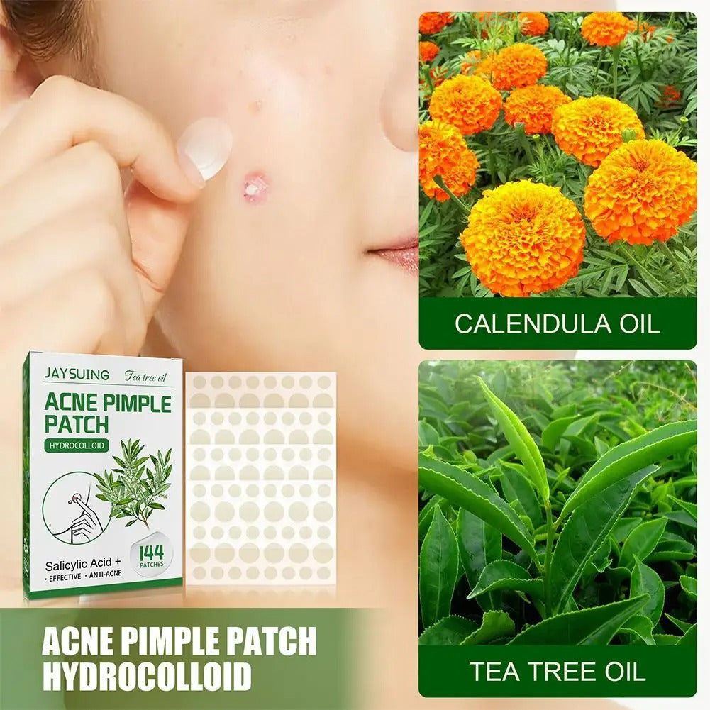 Acne pimple patch with tea tree oil and calendula for effective blemish treatment.